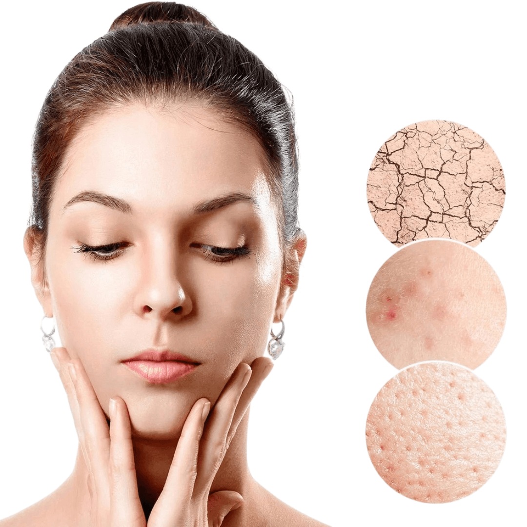 ClearLift - Bezprzewodowy Peeling Kawitacyjny